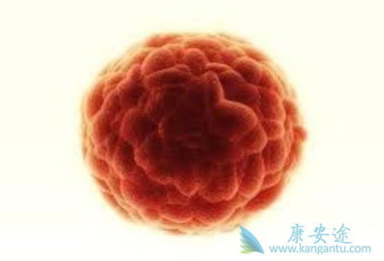 卡波西肉瘤 卡波西肉瘤