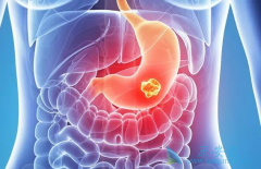 θ��������ʹ�ø��������ƺ���ҩ�ɻ�������������