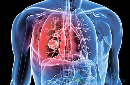 克唑替尼 克唑替尼