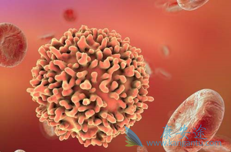 非霍奇金淋巴瘤 非霍奇金淋巴瘤