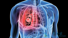 ����ALK�������Եķΰ�ҩ������Щ���������ҩ��