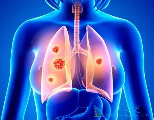 靶向药物 靶向药物