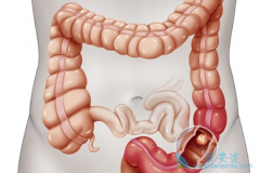 ������������RASҰ�����Ұ��ֱ�������ߵ�ת�����Ƿǳ������