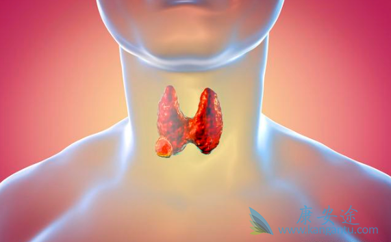 甲状腺癌症 甲状腺癌症