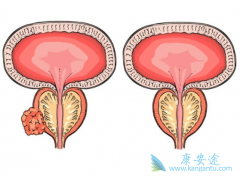 �ٴ��ϳ���������ǰ���ٰ�֢״����Щ��