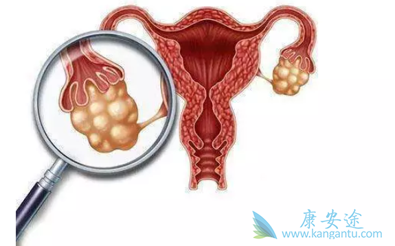 囊肿和肿瘤的区别 囊肿和肿瘤的区别