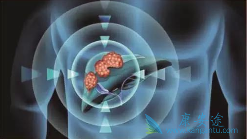 靶向治疗药物 靶向治疗药物