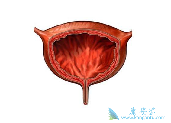 膀胱癌饮食 膀胱癌饮食