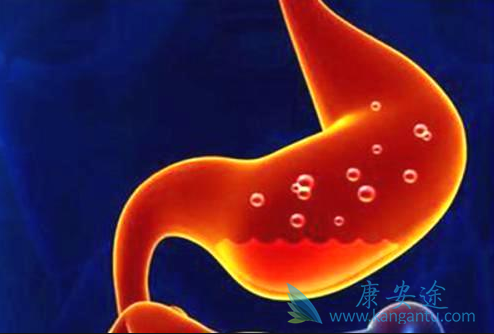 胃肠道间质瘤 胃肠道间质瘤