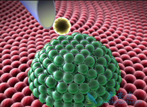 软组织肉瘤 软组织肉瘤