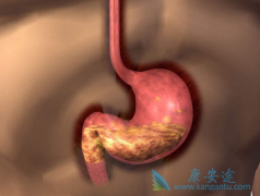 θ������֢״ͨ������Щ��θ��ת���ֻ�������Щ֢״��