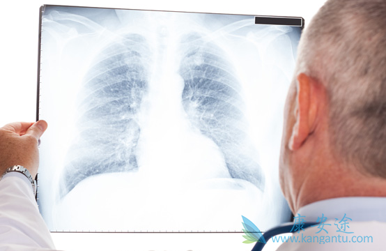 肺癌 肺癌