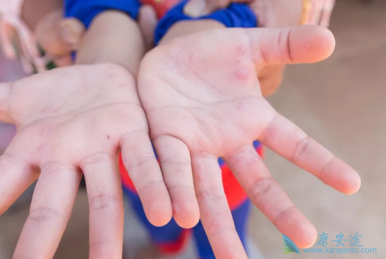 舒尼替尼 舒尼替尼