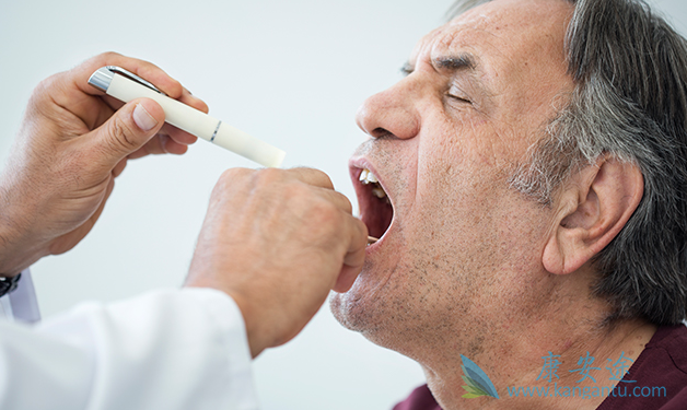 扁桃体癌 扁桃体癌