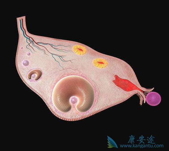 卵巢癌晚期 卵巢癌晚期