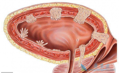 mTOR���Ƽ���άĪ˾�����ư��װ���