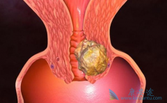 �ٴ�����Ч���ƹ������ķ�������Щ��