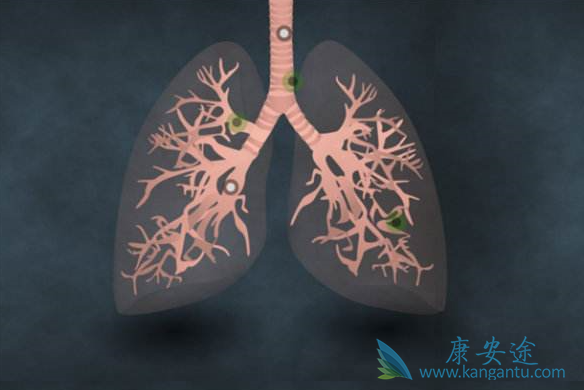 晚期肺癌 晚期肺癌