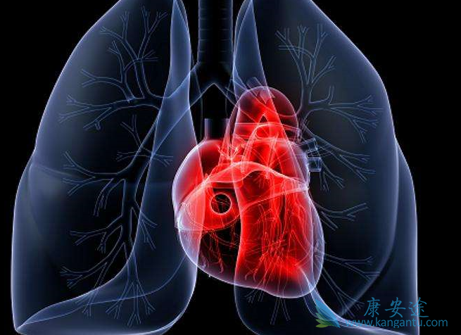 肺动脉高压治疗 肺动脉高压治疗