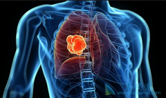 �����߷ΰ���ת�ƻ����������Ƶ���Ч��