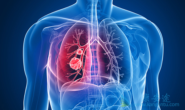 转移性肺癌 转移性肺癌