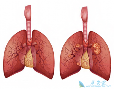 ��������/������������Щ�ΰ�ͻ�仼����Ч��