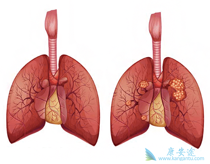 布加替尼 布加替尼