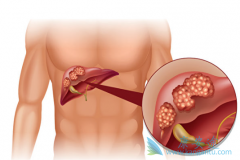 ���Ӱ�������ҩ���ط����������������ƽ��Ǹΰ����Ƶ���Ҫ����