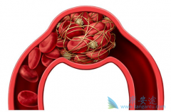 �쳣��Ѫ�ǰ�Ѫ��������֢״֮һ