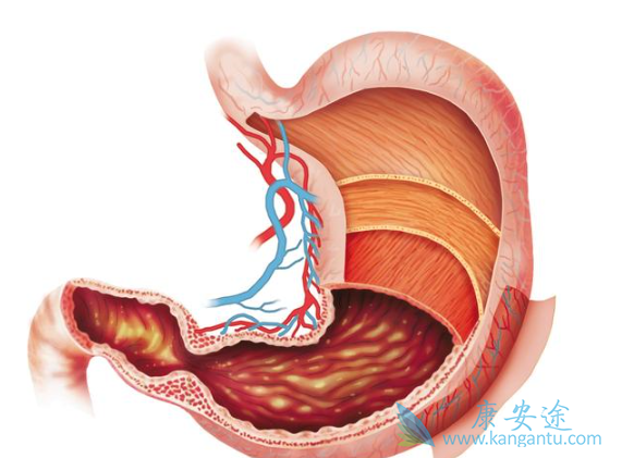 胃癌的治疗 胃癌的治疗