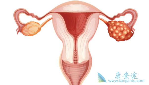 卵巢癌分期 卵巢癌分期