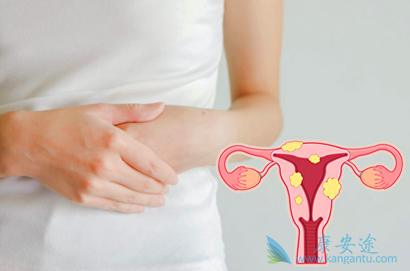 妇科肿瘤 妇科肿瘤