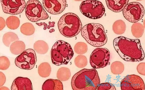 白血病的起因 白血病的起因