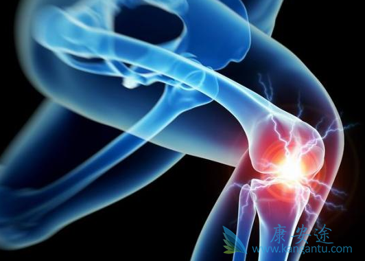 多发性骨髓瘤 多发性骨髓瘤