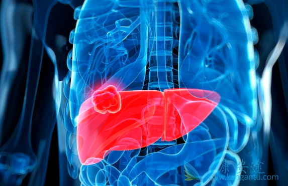 肺癌肝转移 肺癌肝转移
