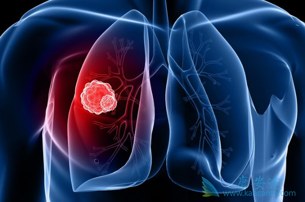 肺癌的治疗 肺癌的治疗