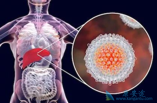 丙肝会传染吗 丙肝会传染吗