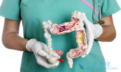 �᳦�������ܻ���ȡ������Щ���棿