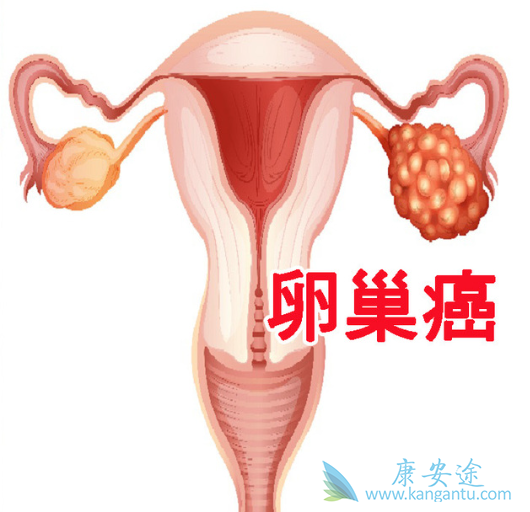 卵巢癌化疗 卵巢癌化疗