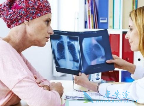 三阴性乳腺癌 三阴性乳腺癌