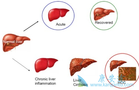 乙肝表面抗体 乙肝表面抗体