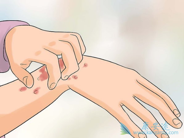 地塞米松 地塞米松