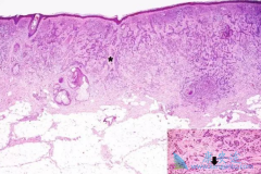 �������뺬����������ϻ�ɽ��ͻ���ϸ�����Ļ�������
