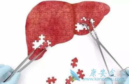 丙肝症状 丙肝症状