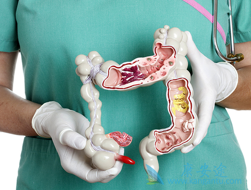 结直肠癌 结直肠癌