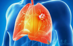 ��ķ����(Keytruda)�ڷΰ�����������ռ����Ҫ��λ