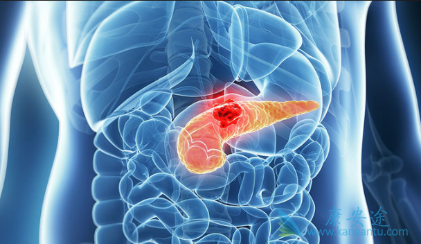 胰腺癌能活多久 胰腺癌能活多久