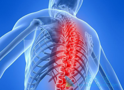 肺癌骨转移 肺癌骨转移