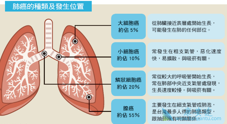 小细胞肺癌 小细胞肺癌