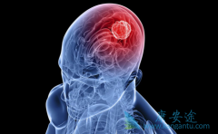 ����ж����������߽�����������֮���Ƿ���Ҫ���ƣ�